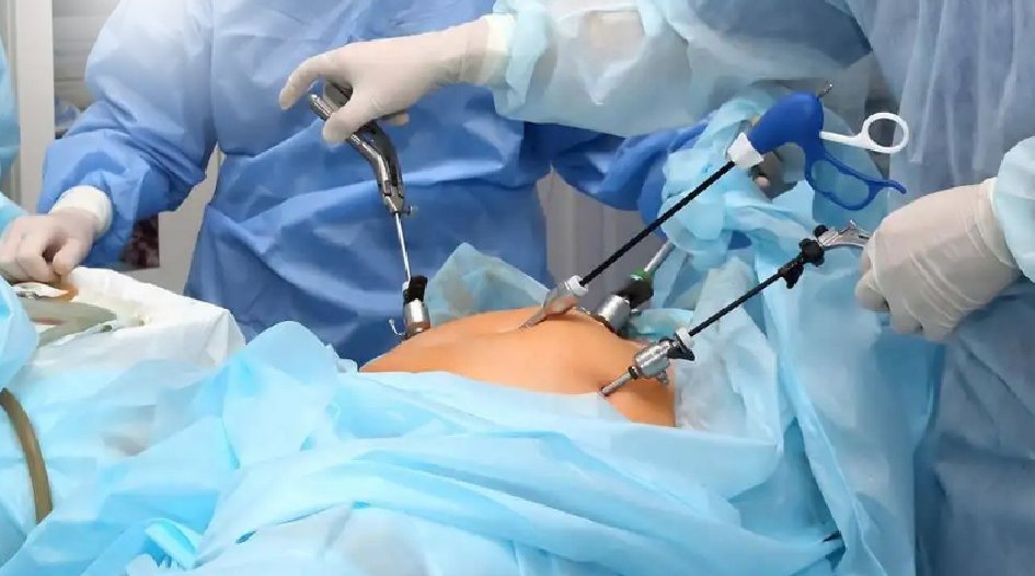 Laparoscopic Surgery Girgaon Charni Road